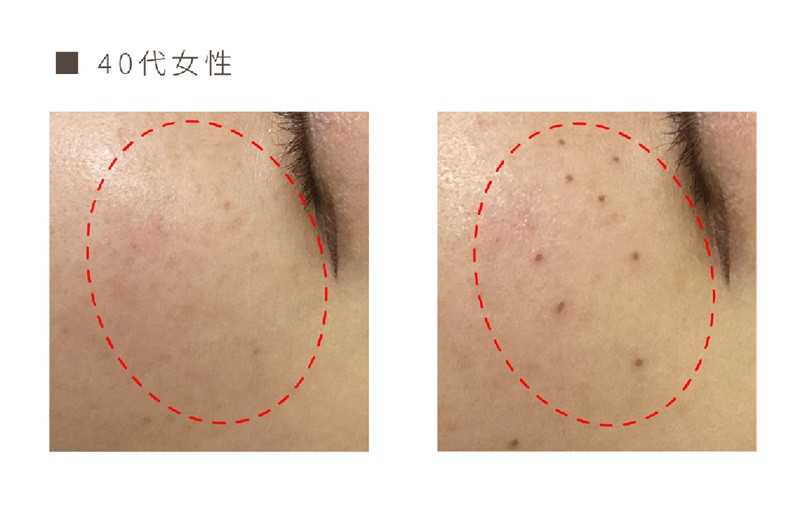 リアージュ(シミケア)30分コース 5回券 フェイシャルコース クレンジング 角質ケア マスク ヘッドマッサージ 低周波パルス コース チケット 5回分 セット プライベートサロン Bodycare Salon MYSA 山梨県 北杜市