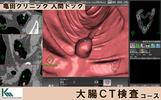 【亀田クリニック人間ドック】大腸CT検査コース　１名様（単独）　[0130-0001] 411569 - 千葉県鴨川市