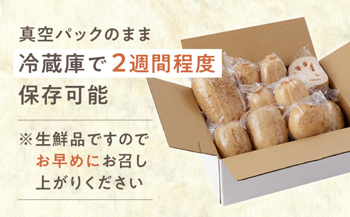 収穫から24時間以内に出荷！新鮮なれんこんをお届けします！