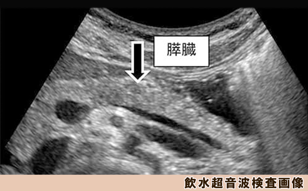 「飲水超音波検査」は、飲水することで胃の背側にある膵臓の観察をしやすくし、通常の超音波検査よりも入念に膵臓を観察します。
